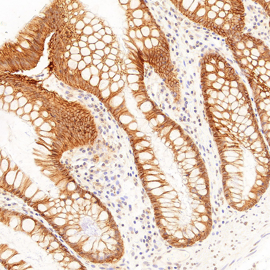 CA12 Rabbit Polyclonal Antibody