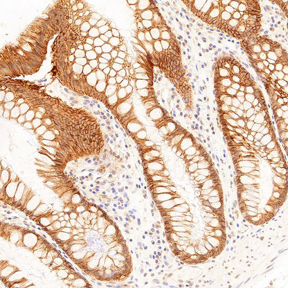 CA12 Rabbit Polyclonal Antibody