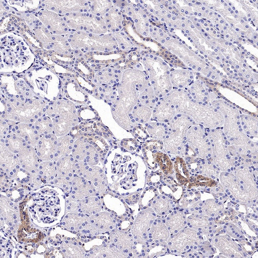 KL Recombinant Rabbit mAb (S-2245-169)