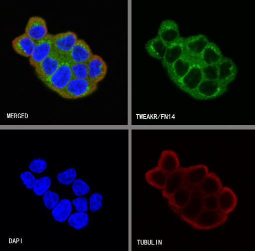TWEAKR/FN14 Recombinant Rabbit mAb (S-913-1)