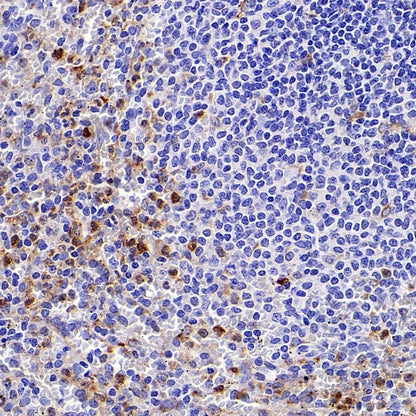Progranulin Recombinant Rabbit mAb (S-2202-46)