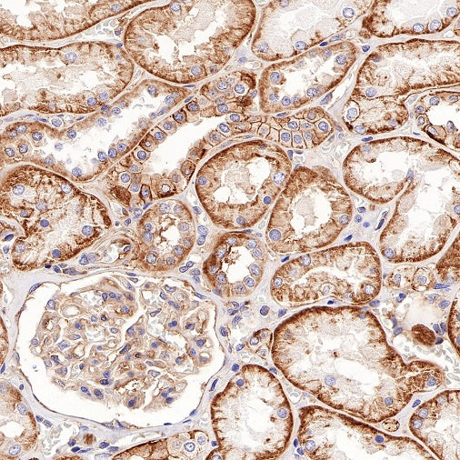 CD46 Recombinant Rabbit mAb (S-668-119)