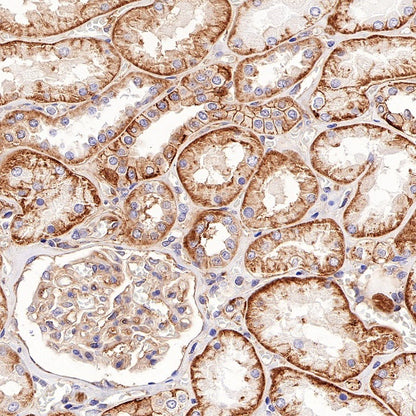 CD46 Recombinant Rabbit mAb (S-668-119)