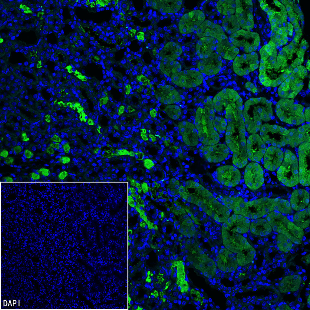 PCK1 Rabbit Polyclonal Antibody