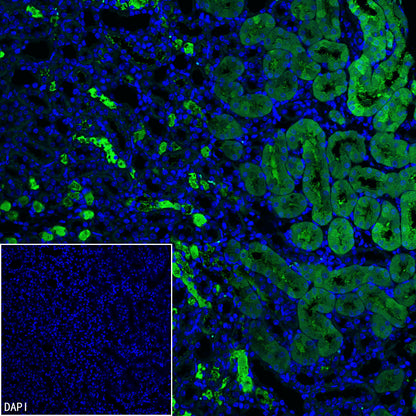 PCK1 Rabbit Polyclonal Antibody