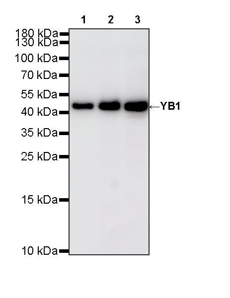 YB1 Recombinant Rabbit mAb (S-6245)
