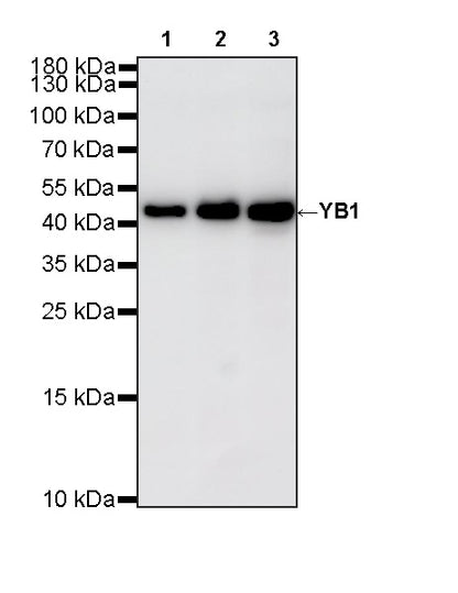 YB1 Recombinant Rabbit mAb (S-6245)