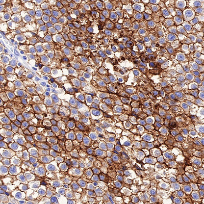 PLAP+ALPI Recombinant Rabbit mAb (SDT-167-155)