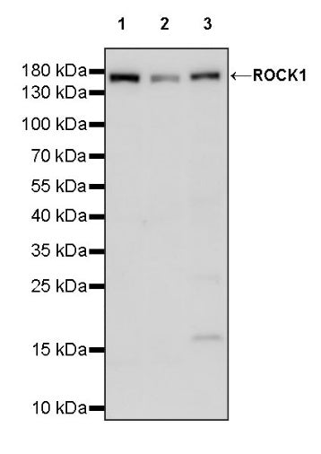 ROCK1 Recombinant Rabbit mAb (S-1304-153)