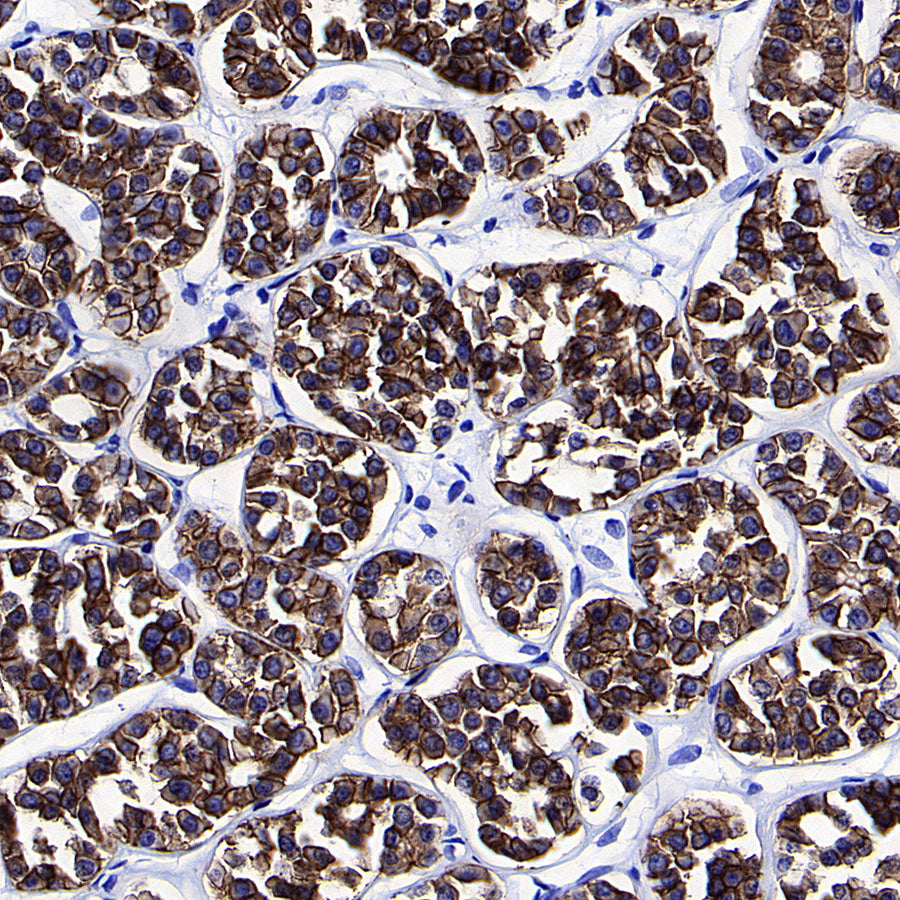 BSND Recombinant Rabbit mAb (S-3815-70)
