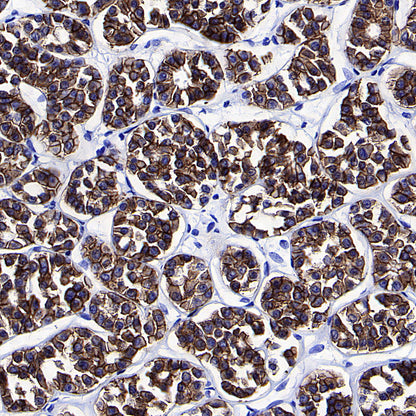 BSND Recombinant Rabbit mAb (S-3815-70)