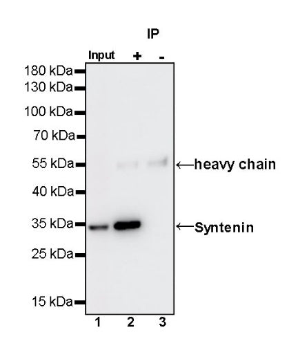 Syntenin Recombinant Rabbit mAb (S-1692-5)