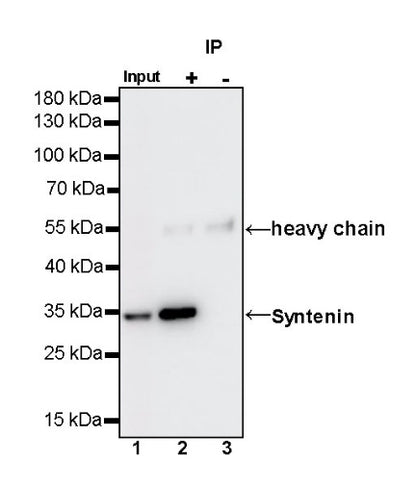 Syntenin Recombinant Rabbit mAb (S-1692-5)