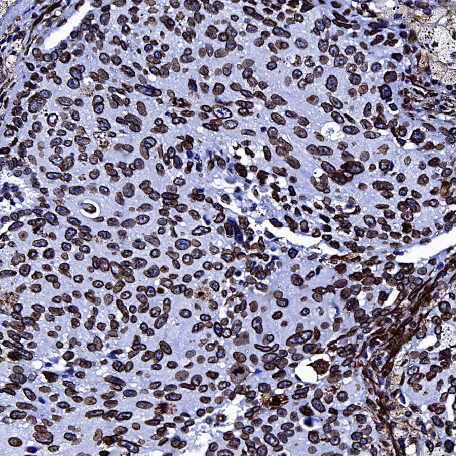 Lamin A/C Recombinant Rabbit mAb (S-5671)