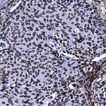 Lamin A/C Recombinant Rabbit mAb (S-5671)