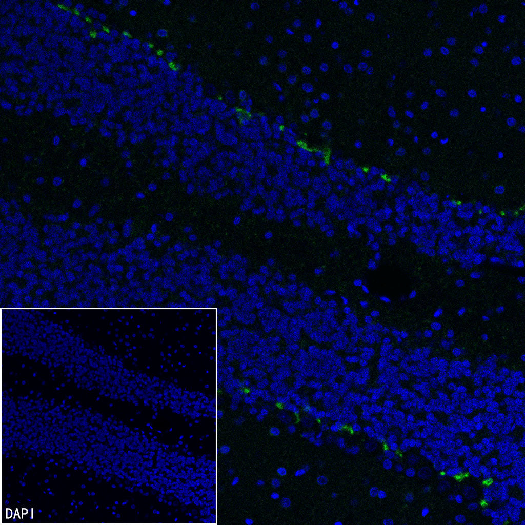 KCNA2 Recombinant Rabbit mAb (S-3939-53)