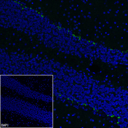 KCNA2 Recombinant Rabbit mAb (S-3939-53)