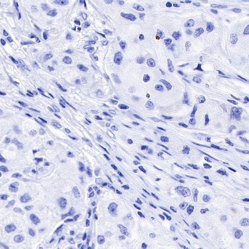 Inhibin alpha Recombinant Rabbit mAb (SDT-R307)