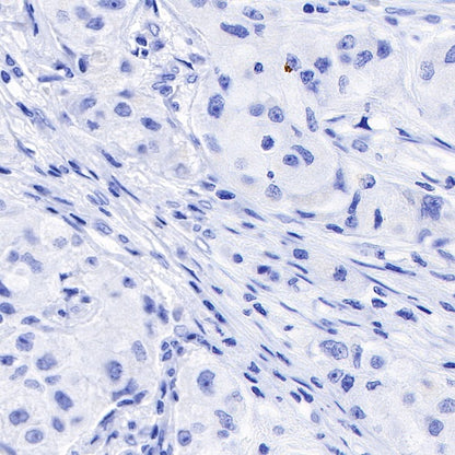 Inhibin alpha Recombinant Rabbit mAb (SDT-R307)