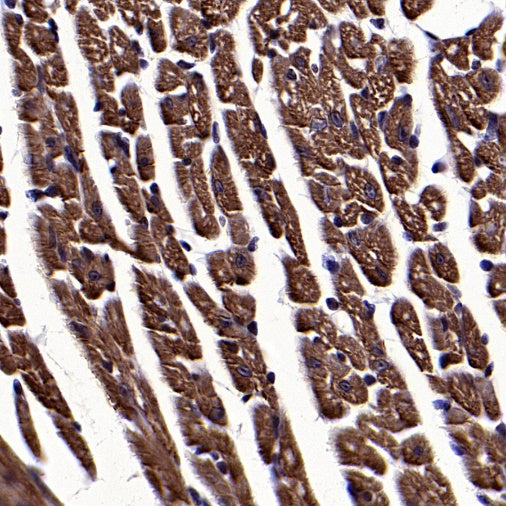Cardiac troponin T (TNNT2) Recombinant Rabbit mAb (SDT-2894-34)