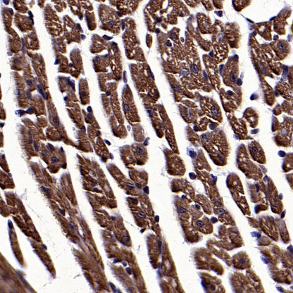Cardiac troponin T (TNNT2) Recombinant Rabbit mAb (SDT-2894-34)