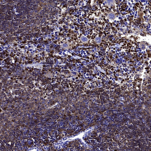 PKC delta Recombinant Rabbit mAb (S-2611-39)