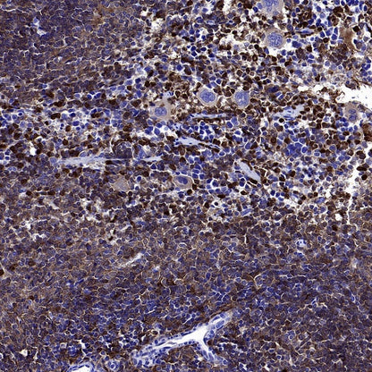 PKC delta Recombinant Rabbit mAb (S-2611-39)