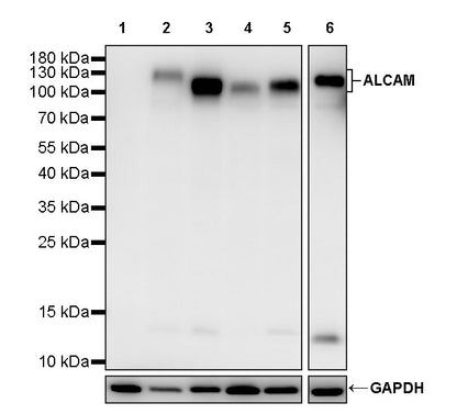 ALCAM Recombinant Rabbit mAb (S-4080-40)