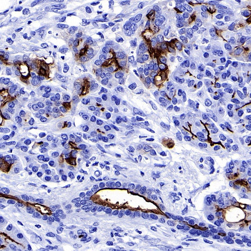 S-RMab® MUC1/EMA Recombinant Rabbit mAb (SDT-776-49)