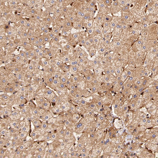 PFKL+PFKM Recombinant Rabbit mAb (S-1302-31)