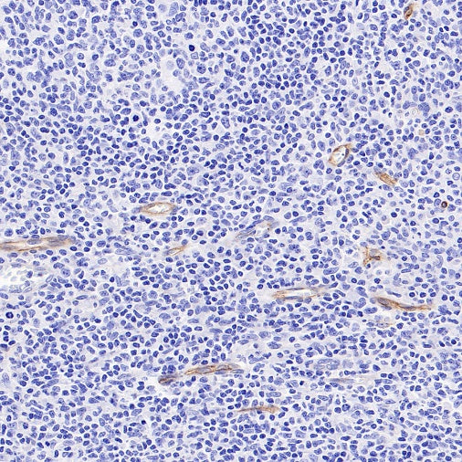 VEGF Receptor 2/FLK-1 Recombinant Rabbit mAb (SDT-1519-144)