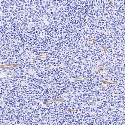 VEGF Receptor 2/FLK-1 Recombinant Rabbit mAb (SDT-1519-144)