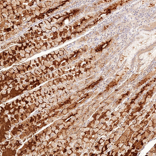 AMPKα Recombinant Rabbit mAb (S-784-68)