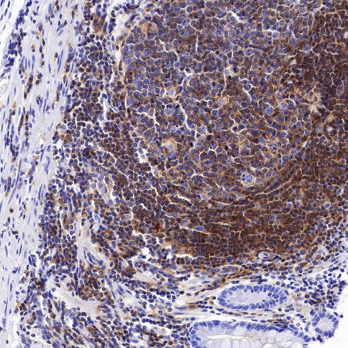 CSF-1R Recombinant Rabbit mAb (S-R219)