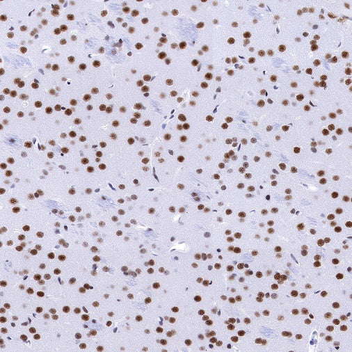 SMARCA2/BRM Recombinant Rabbit mAb (S-1568-17)