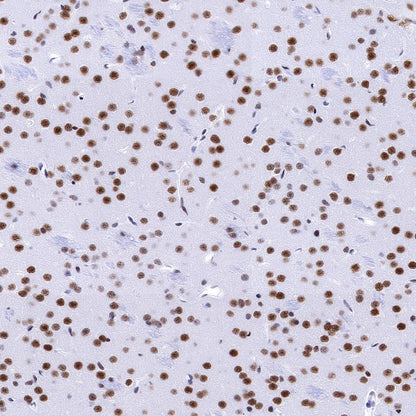 SMARCA2/BRM Recombinant Rabbit mAb (S-1568-17)