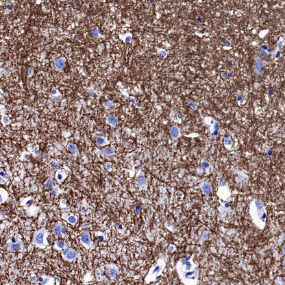 Myelin Oligodendrocyte Glycoprotein (MOG) Recombinant Rabbit mAb (S-1384-61)