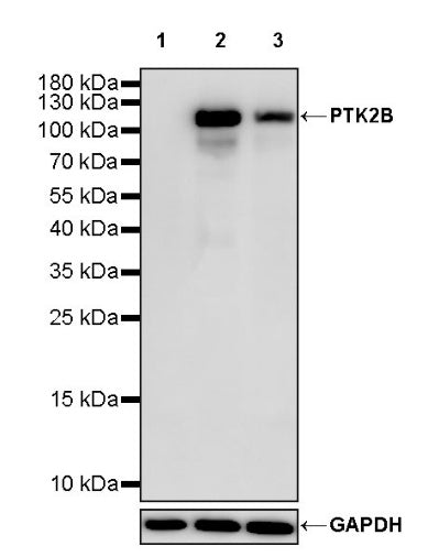 PTK2B Recombinant Rabbit mAb (S-2417-80)