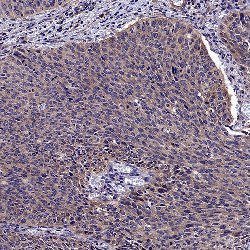 APC6 Recombinant Rabbit mAb (S-2550-48)