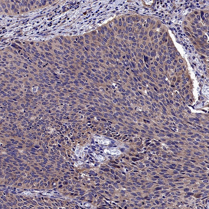 APC6 Recombinant Rabbit mAb (S-2550-48)