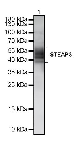 STEAP3 Recombinant Rabbit mAb (S-4466-26)