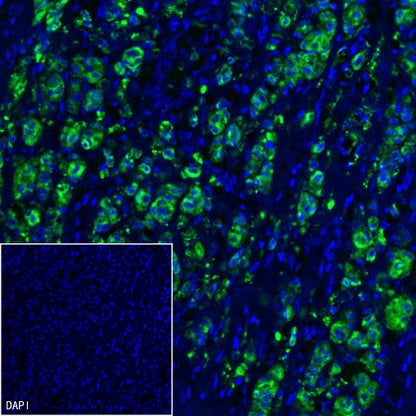MelanA Recombinant Rabbit mAb (SDT-3352)