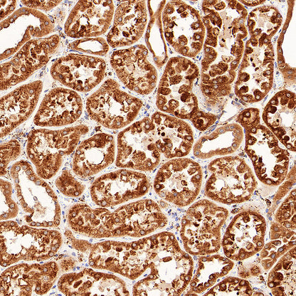 P4HB Recombinant Rabbit mAb