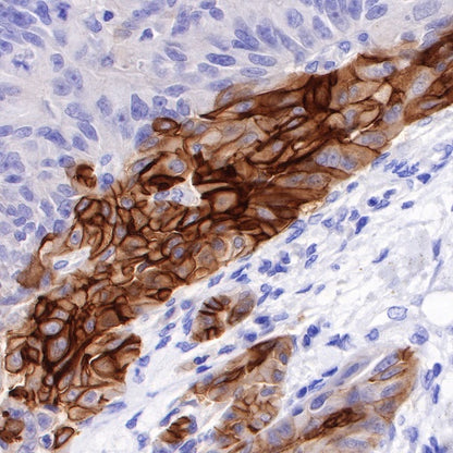B7-H4 Recombinant Rabbit mAb (SDT-314-447-2)