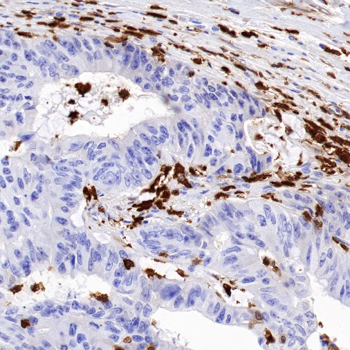 S100A4 Recombinant Rabbit mAb (S-1655-26)