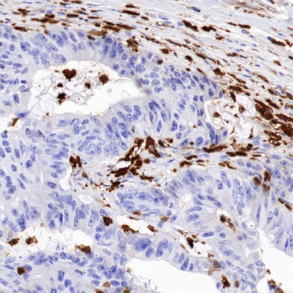 S100A4 Recombinant Rabbit mAb (S-1655-26)