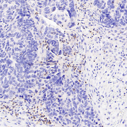 Stat4 Recombinant Rabbit mAb (S-4916-70)