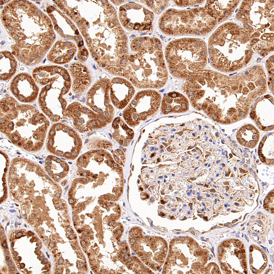 Urokinase Recombinant Rabbit mAb (S-5949)