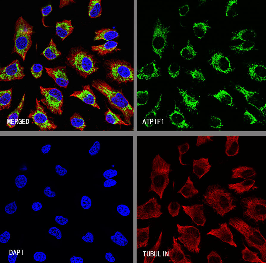 ATPIF1 Recombinant Rabbit mAb (S-3849-49)