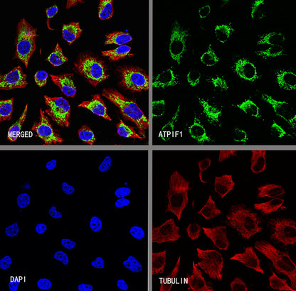 ATPIF1 Recombinant Rabbit mAb (S-3849-49)